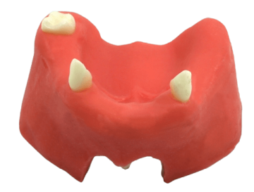 Mandible & Maxilla with Soft Gums for Implant Training