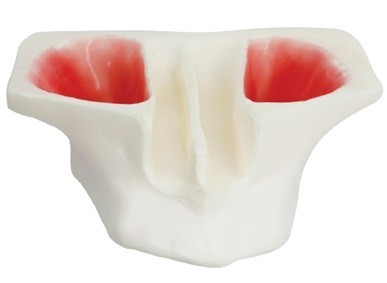 Sinus Lift Model - White Resin