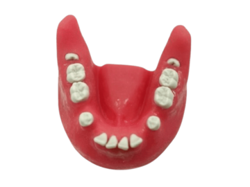 Impacted Tooth Extraction Surgery Dental Jaw Model