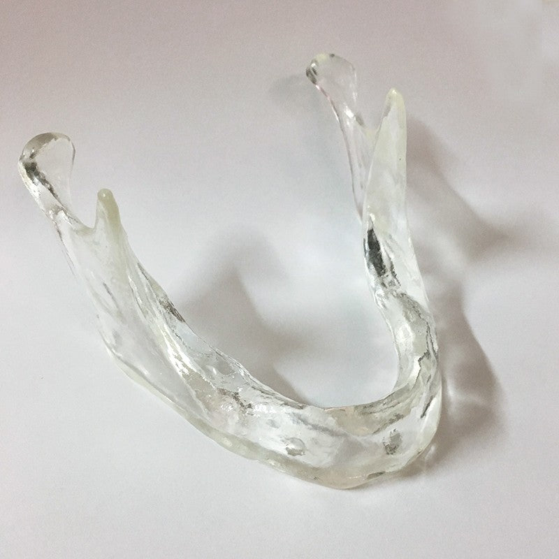Transparent Implant Mandible