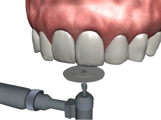 The Tooth Patient Consultation Education Software