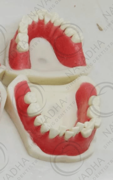 Orthodontic Typodont with Ivorine Teeth
